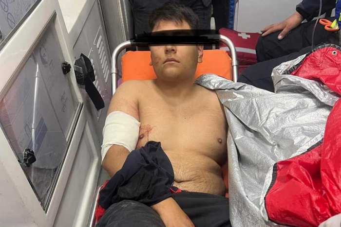 El hijo del candidato fue hospitalizado tras recibir tres impactos de bala. 