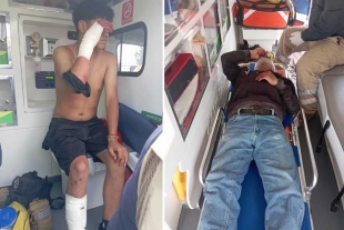 Las autoridades reportaron que, hasta el momento, ambos se encuentran estables y fuera de peligro.